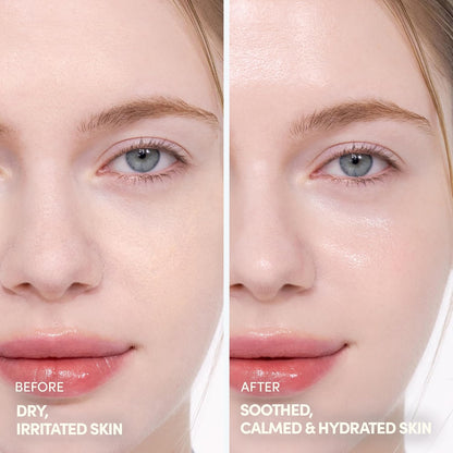 Nourish Your Skin with Soonjung 2X Barrier Repair Cream - Perfect for Sensitive Skin, 2.02 Fl Oz